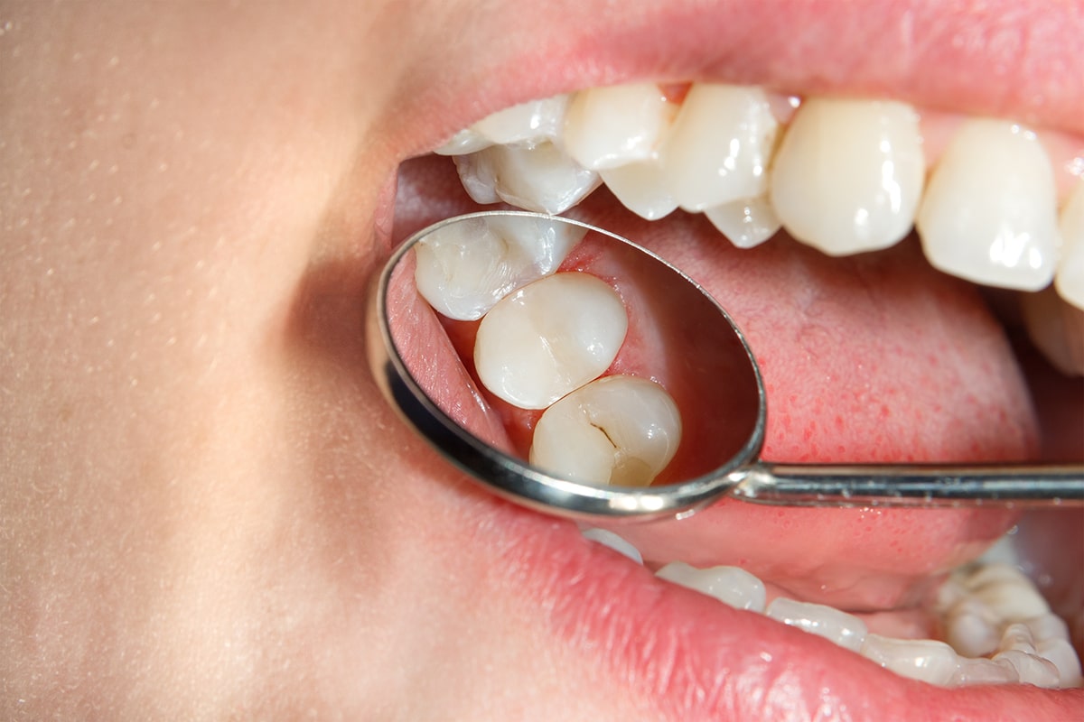 🔴 ¿qué Es La Salud Bucodental Los Mejores Consejos Para Tu Salud 