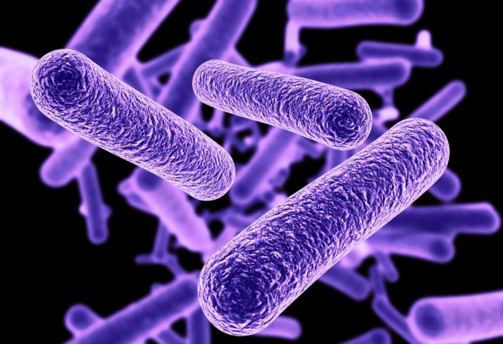 legionella