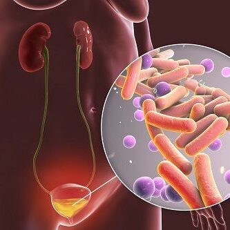 infecciones urinarias