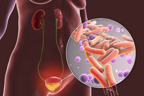 infecciones urinarias