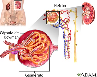 síndrome nefrótico